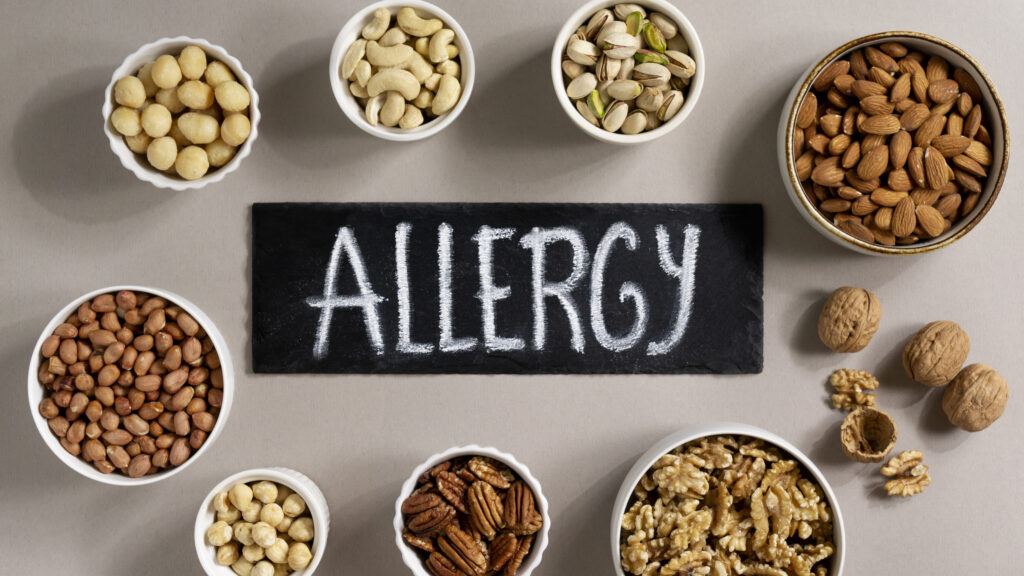 view-allergens-commonly-found-nuts